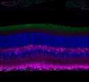 U17. Micorscopy- Immunohistochemical labeling of the mouse retina.