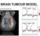 U25 RMN brain tumour model