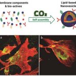 Lipid-based Nanovesicles for Nanomedicine
