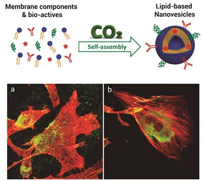 Lipid-based Nanovesicles for Nanomedicine