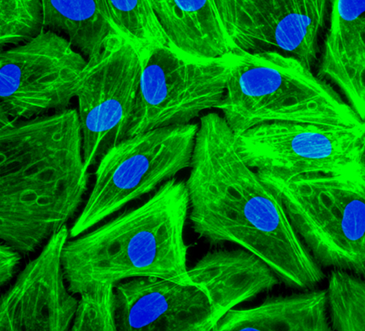 Phalloidin and DAPI staining of human pigmented epithelial cells (ARPE cells)